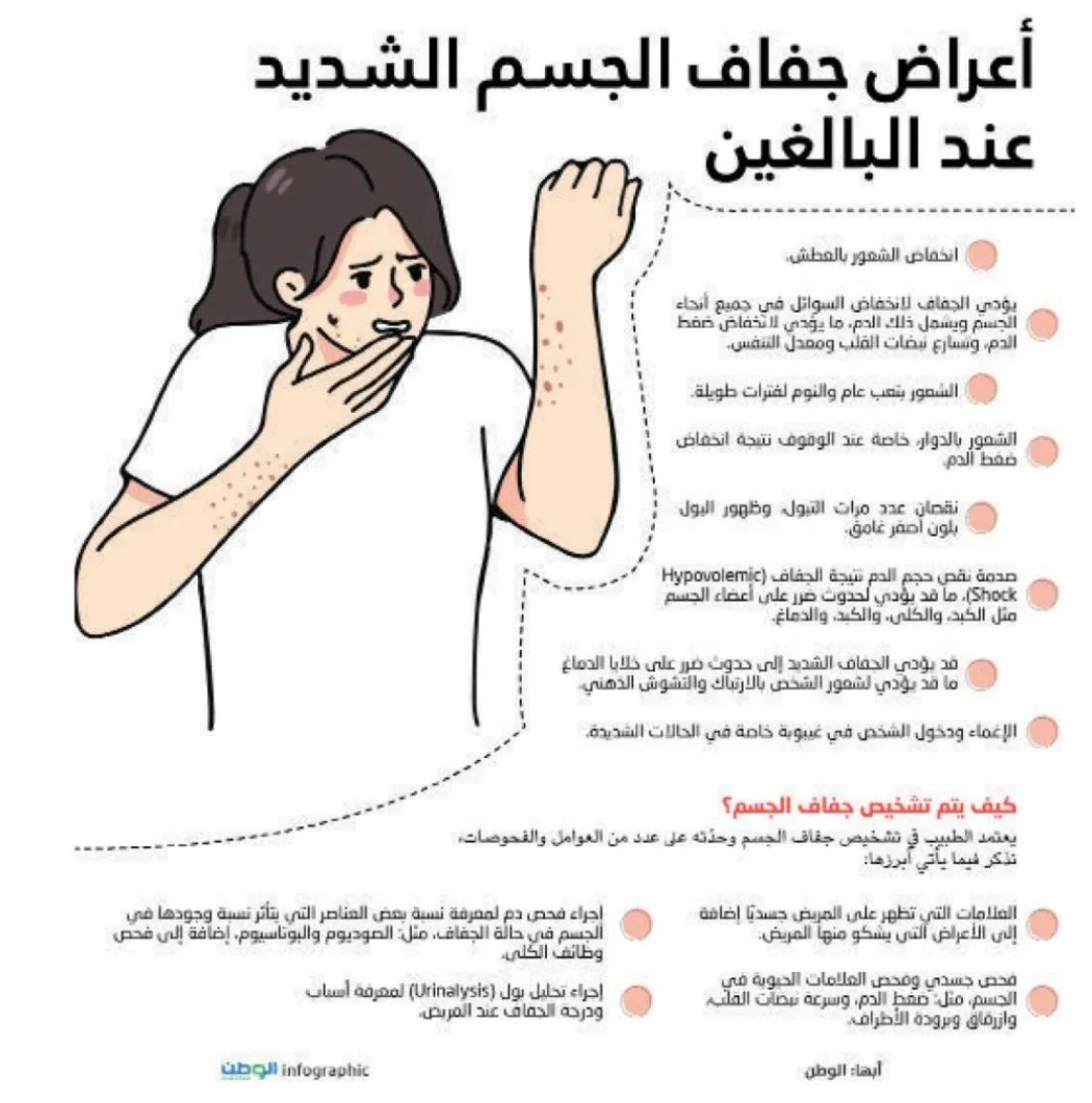 صحيفة الوطن السعودية | أعراض جفاف الجسم الشديد عند البالغين